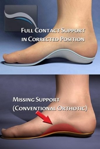 custom made foot orthotics